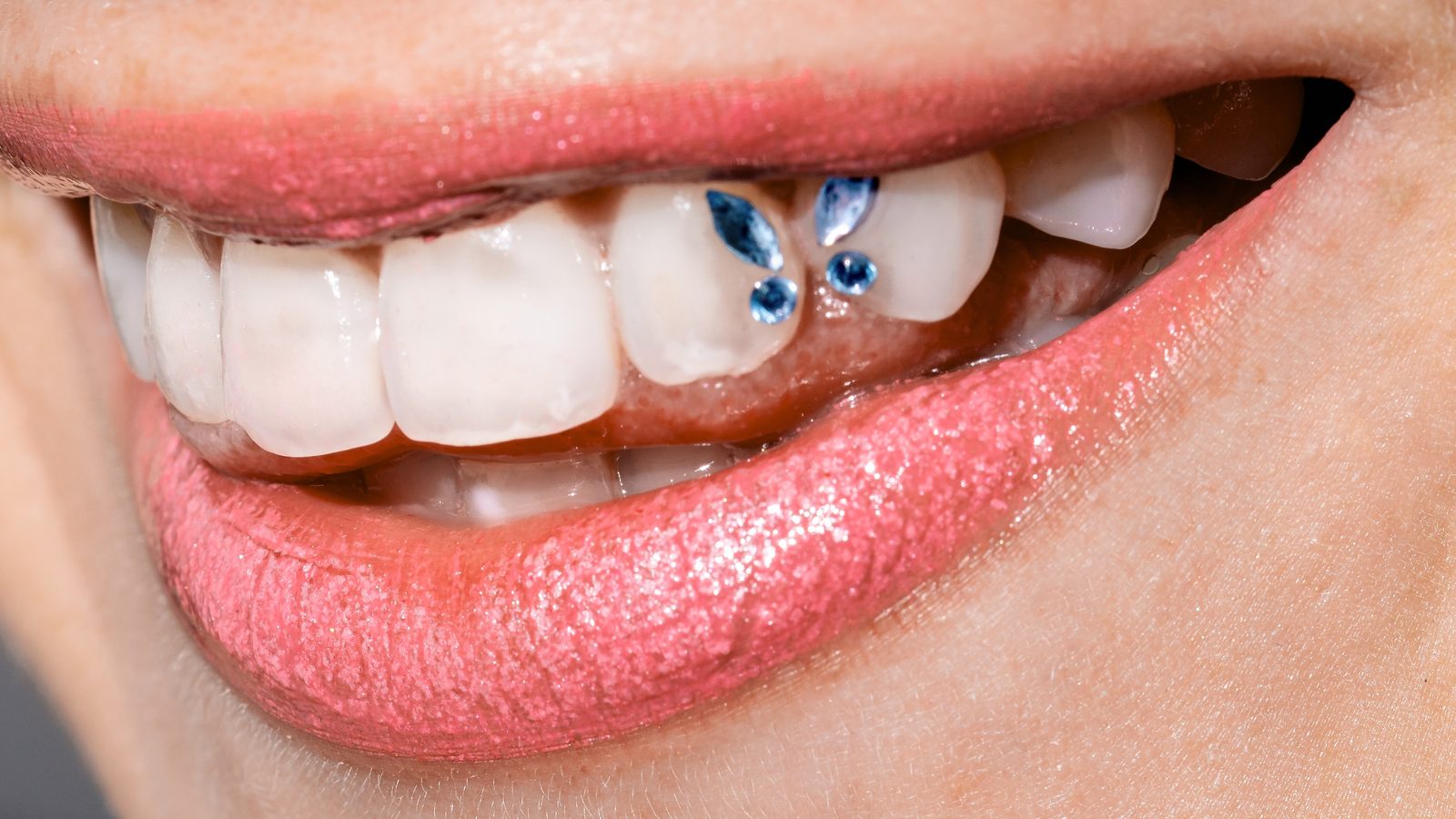 Tooth Gems at Ogilvie Dental in Gloucester